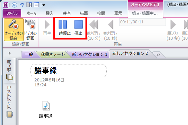 [停止]と[一時停止]が表示されたイメージ